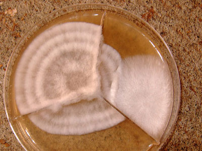 diversos tipos de micelio contaminado en una placa de Petri